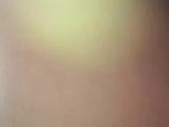Eva Brian Khan consiguió una en la región anal film porno en un yeso.